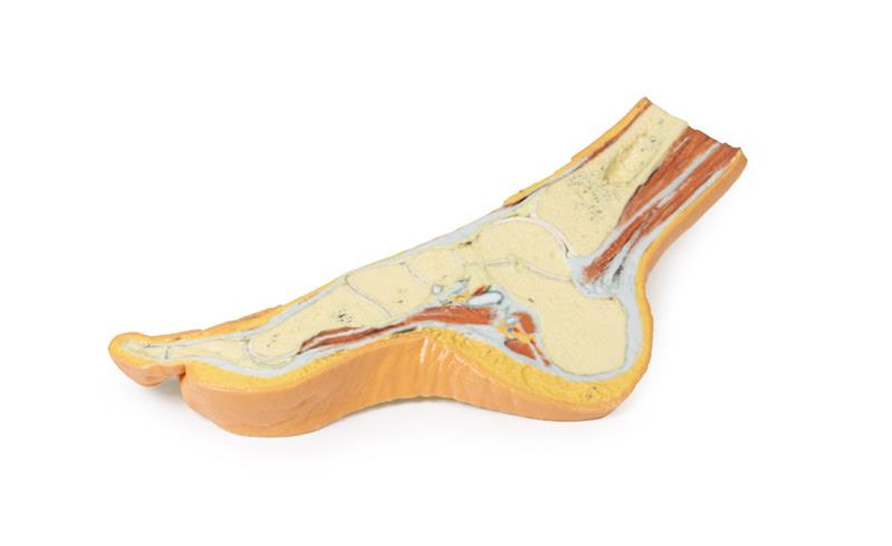 3D Printed Foot - Parasagittal Cross-Section