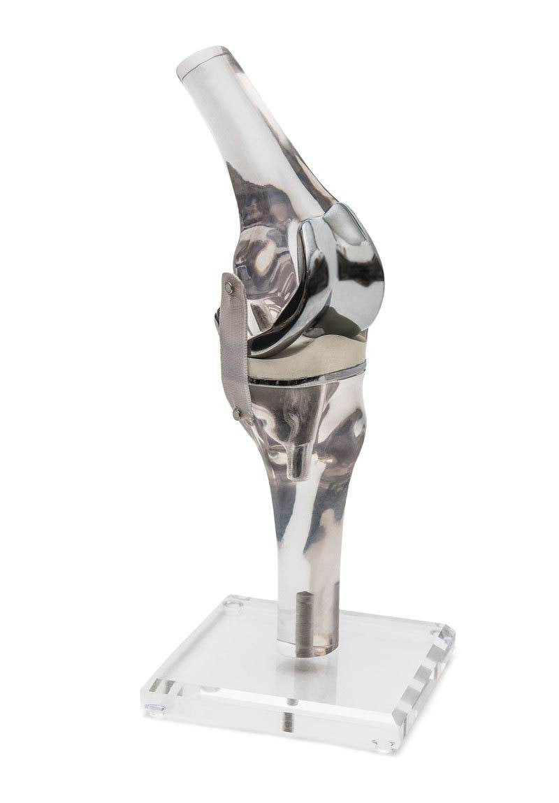 Erler-Zimmer Knee Model With Endoprosthesis | Anatomy Warehouse
