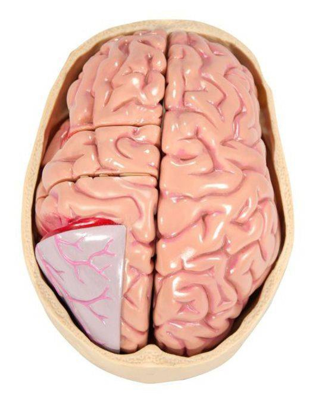 Anatomy Model Brain Diseased in Skull