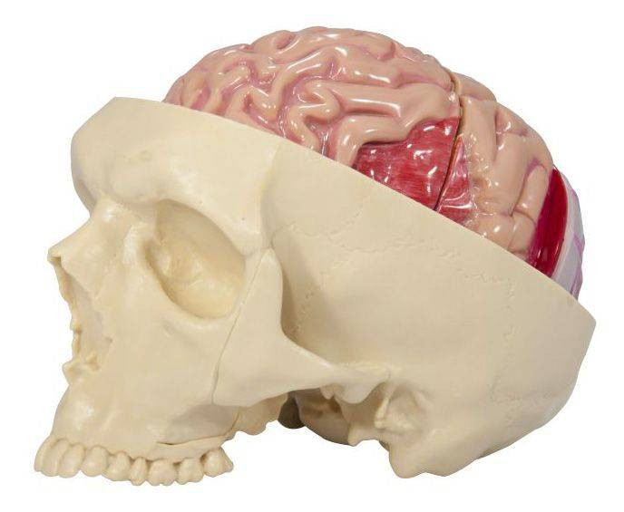 GPI Anatomicals Diseased Brain In Skull Anatomy Model | Anatomy