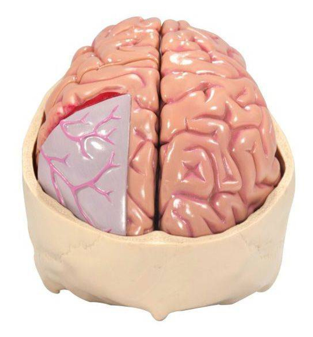 Anatomy Model Brain Diseased in Skull