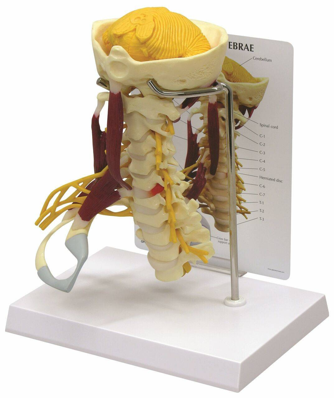 GPI Anatomicals Deluxe Muscled Cervical Anatomy Model