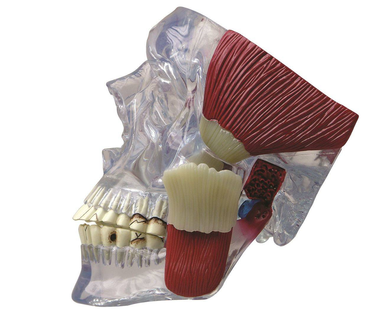 TMJ Clear Skull Anatomy Model