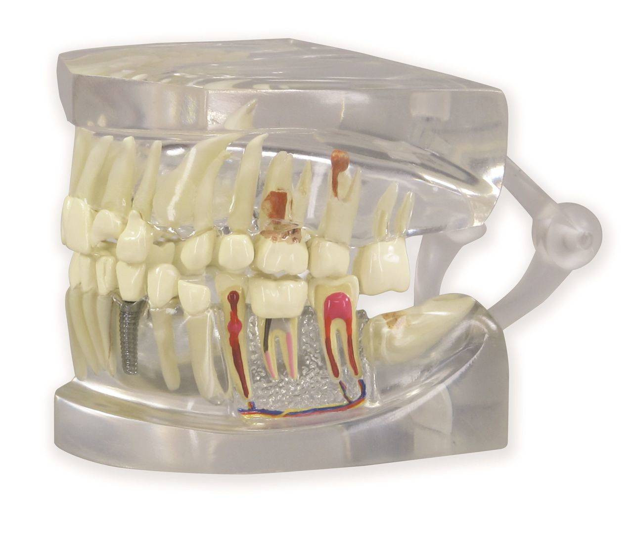 すべての歯科医師のための臨床解剖学に基づいたComprehensive Dental Surgery すべての歯科医師のための臨床解剖学に基づいたComprehensive