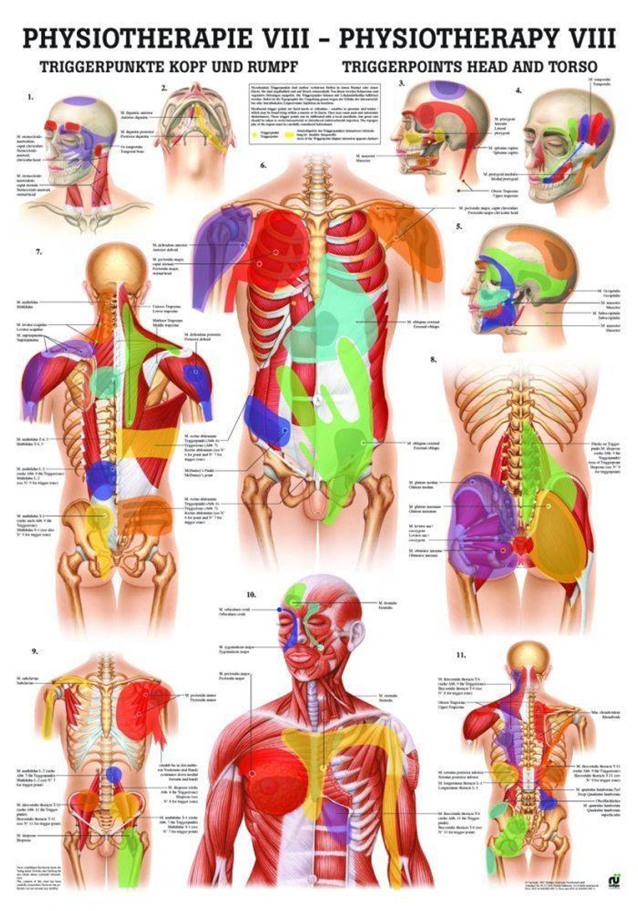 Trigger Points: Head and Torso Laminated Chart