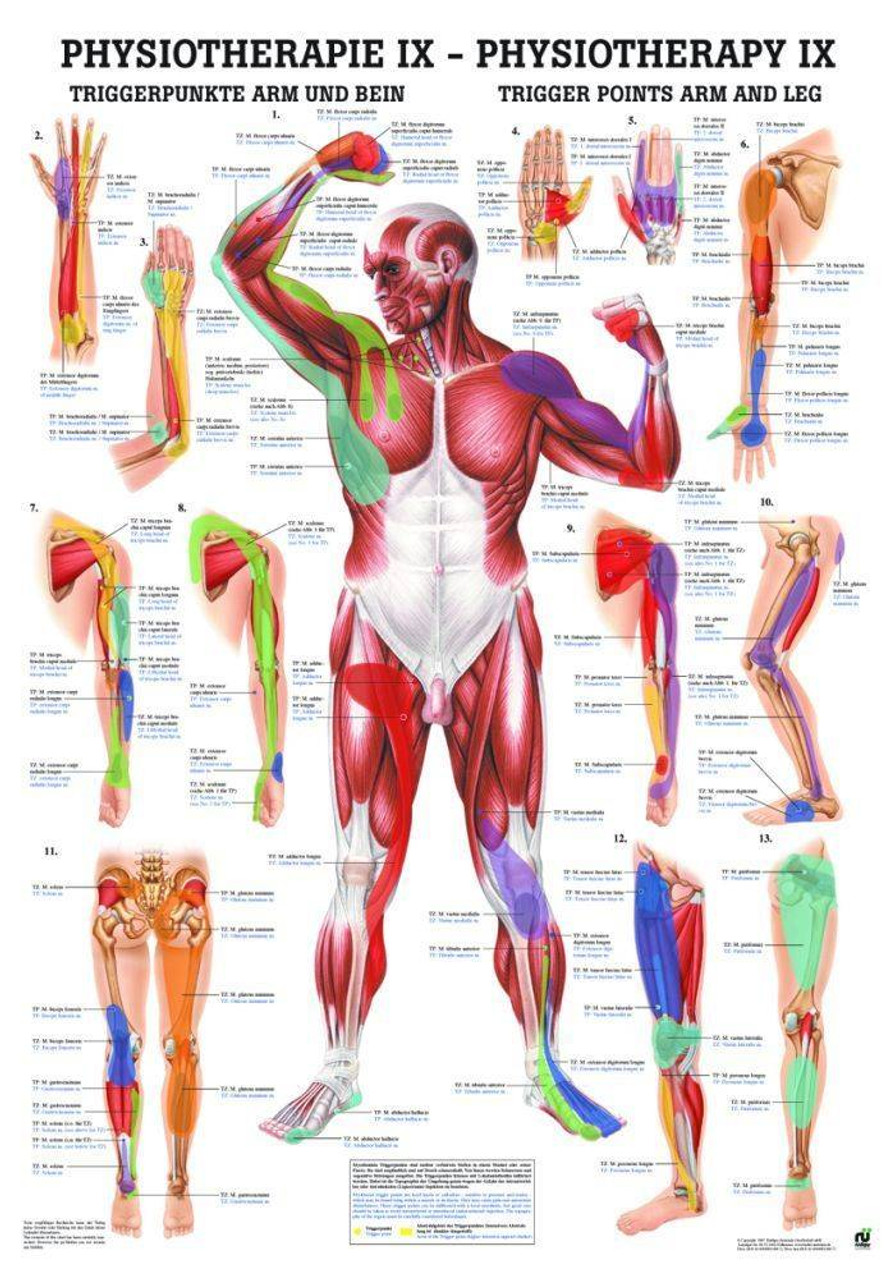 Trigger Points: Arms and Legs Laminated Chart