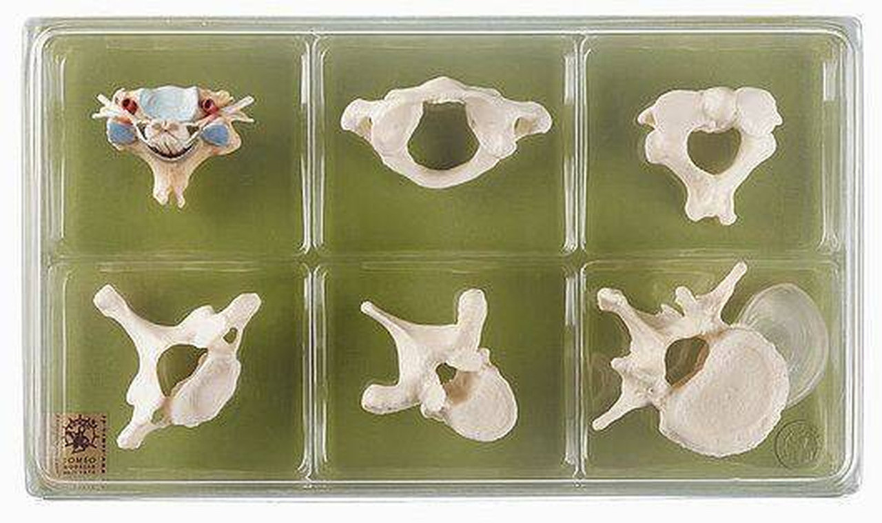 SOMSO Collection of Vertebrae and Spinal Cord | Anatomy Warehouse
