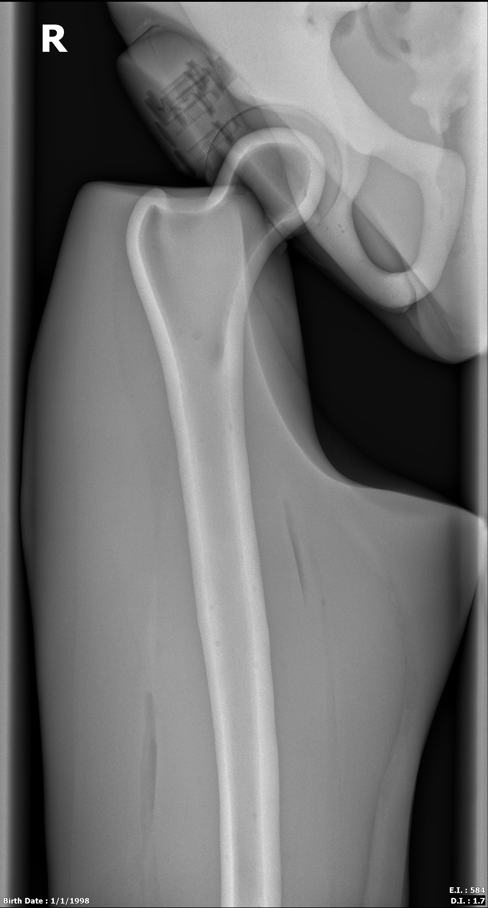 Adult Male Full Body XRay/CT and MRI Phantom Model