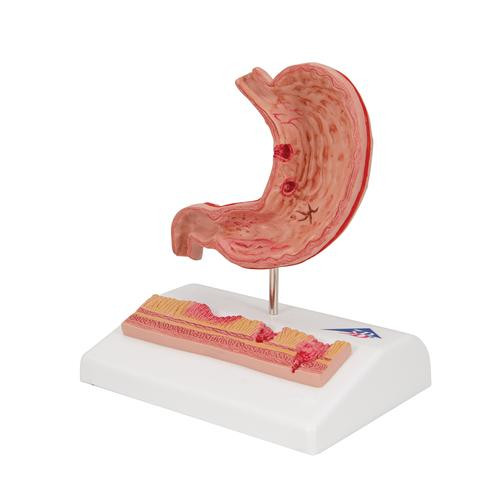Anatomy Model Stomach and Other Organs