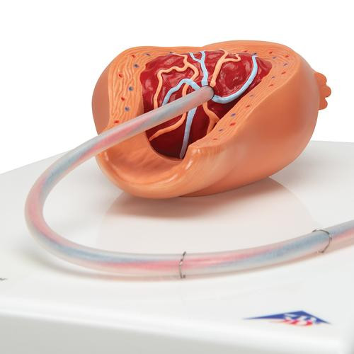 3B Scientific - 5-Stage Birth Process Anatomy Model