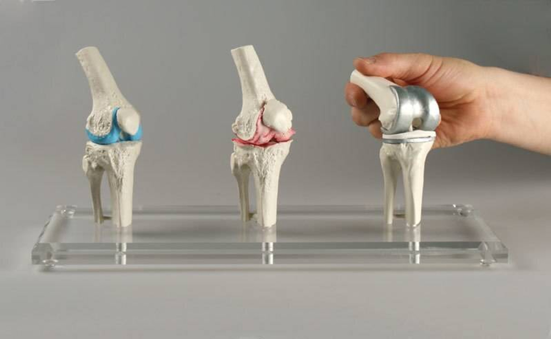 Knee Arthroscopy Model