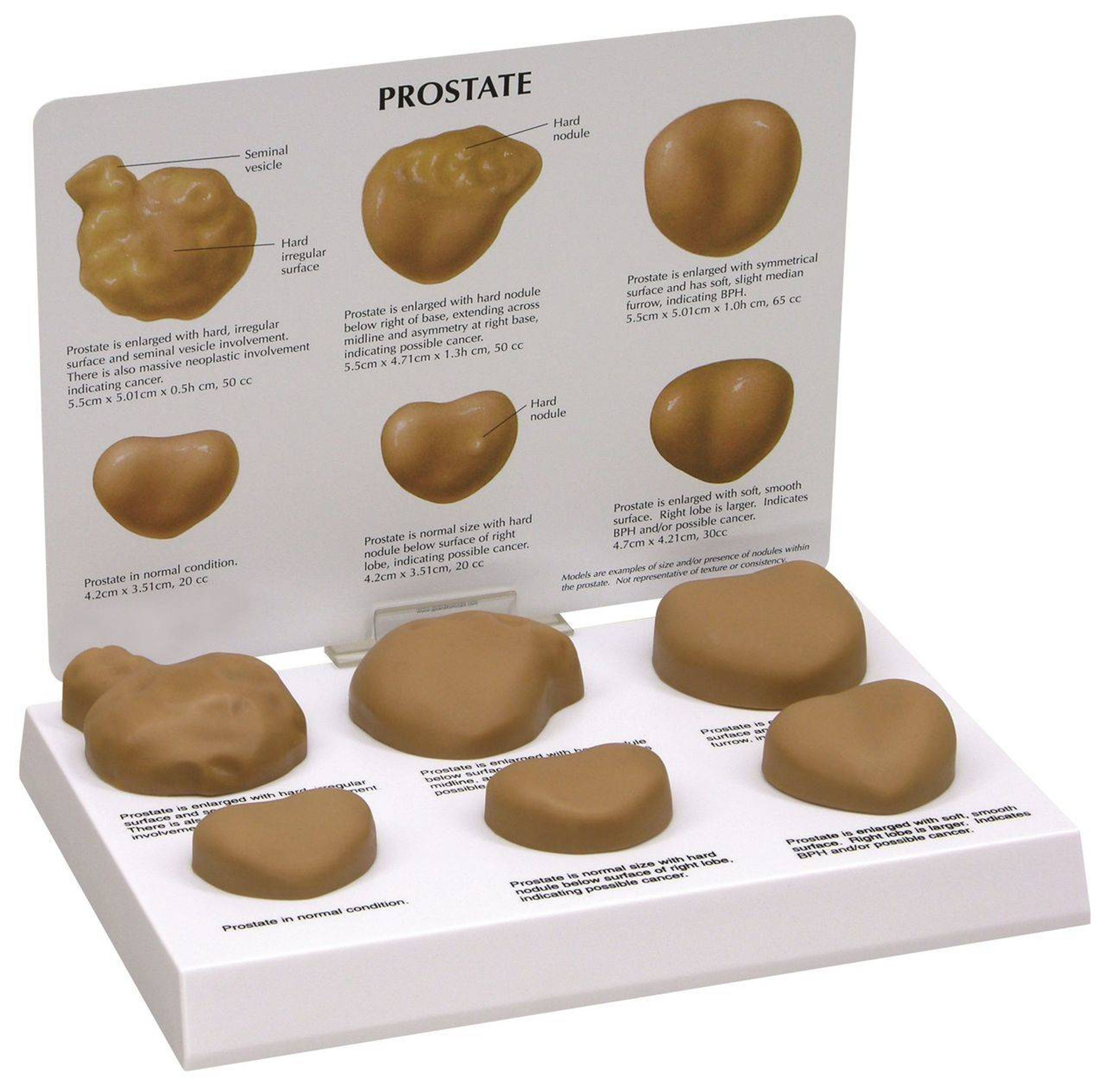 Anatomy Model Prostate