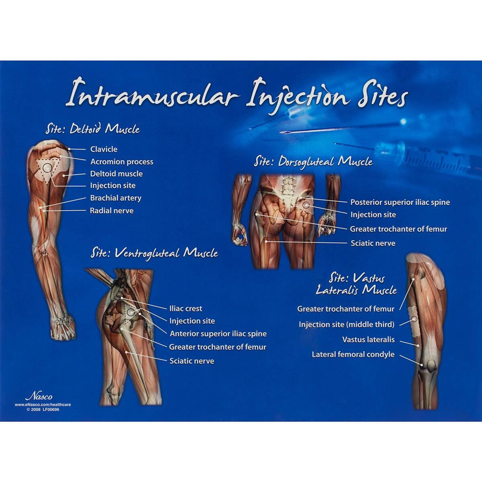 Anatomy Trainer Intramuscular Injection Sites Chart   Lifeform Intramuscular Injection Visual Aid Chart  11258.1603835632 