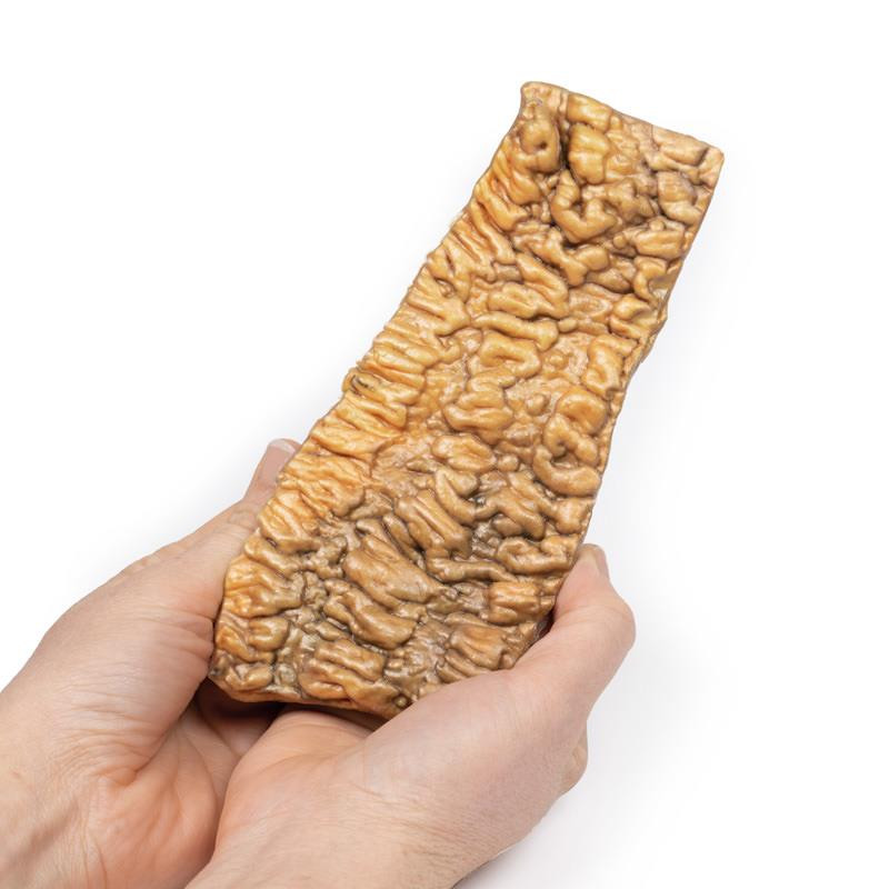 ErlerZimmer 3D Printed Ulcerative Colitis