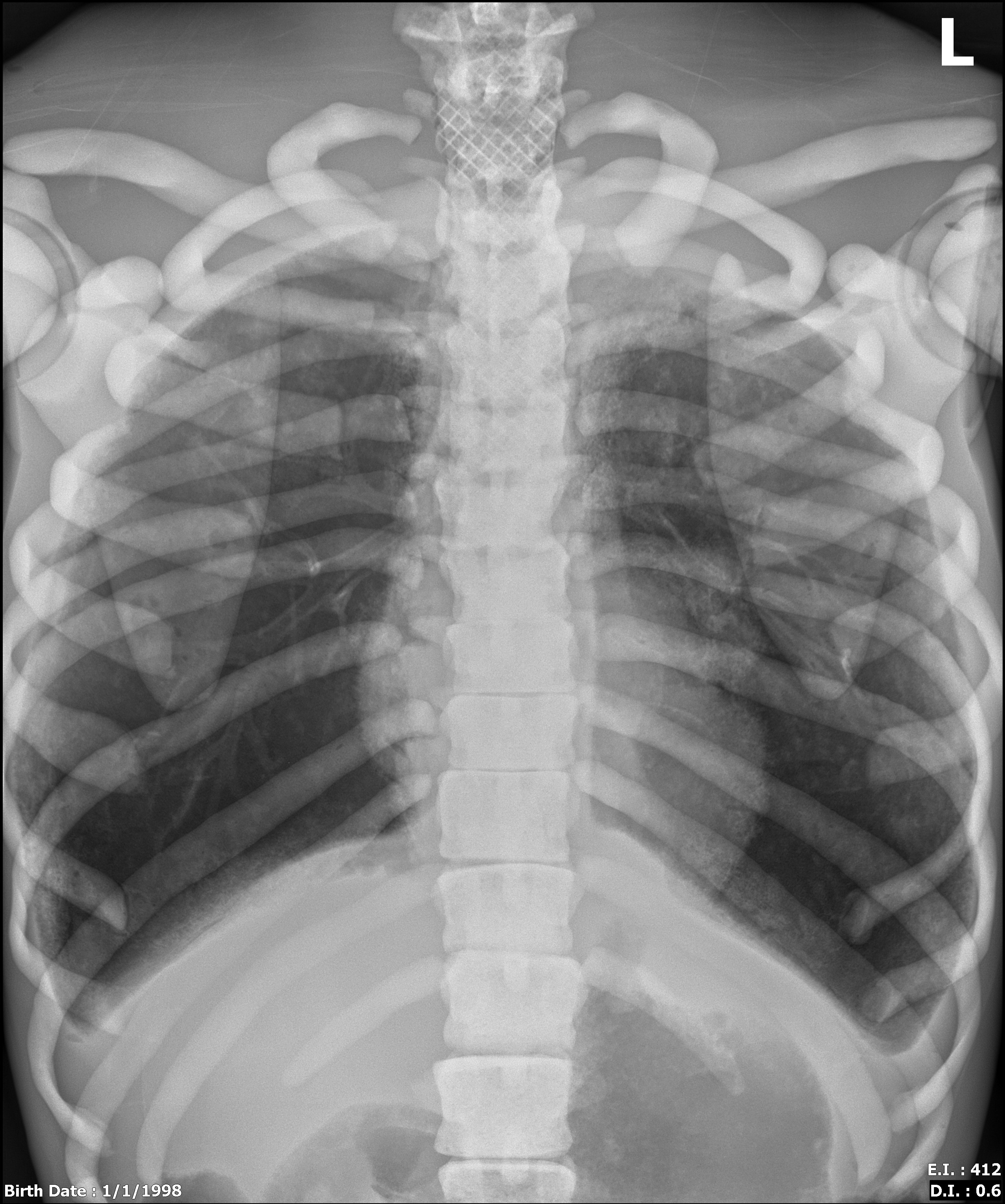 Adult Male Full Body XRay/CT and MRI Phantom Model