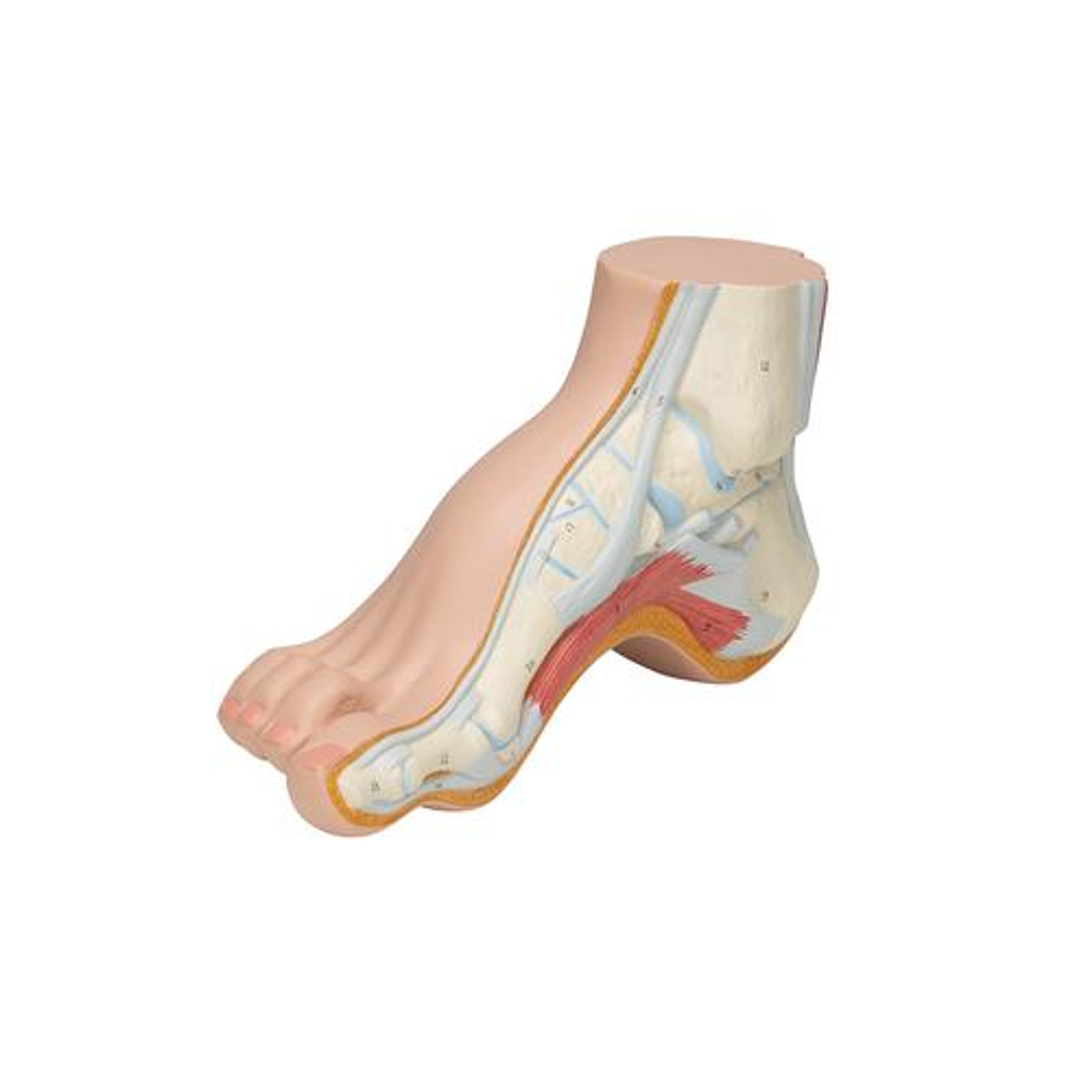 Anatomy Model Pes Hollow Foot (Pes