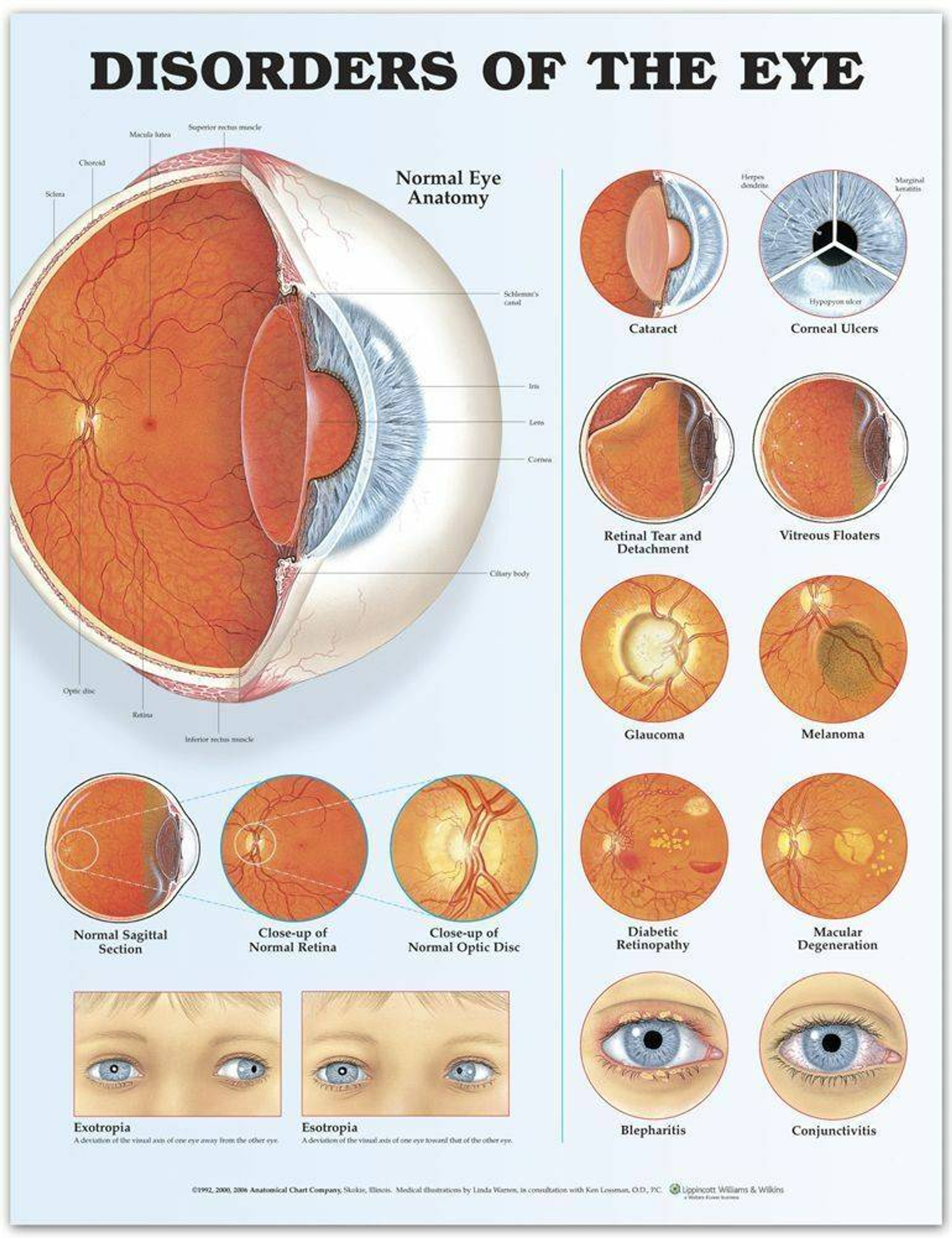 Anatomical Chart Company Disorders Of The Eye Laminated Anatomical Anatomical Chart Company Disorders Of The Eye Laminated Anatomical