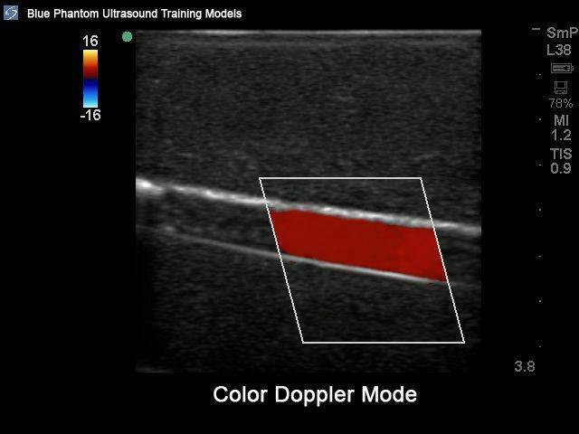 Annie Arterial Insufficiency Leg Model (Includes Ultrasound Doppler ...