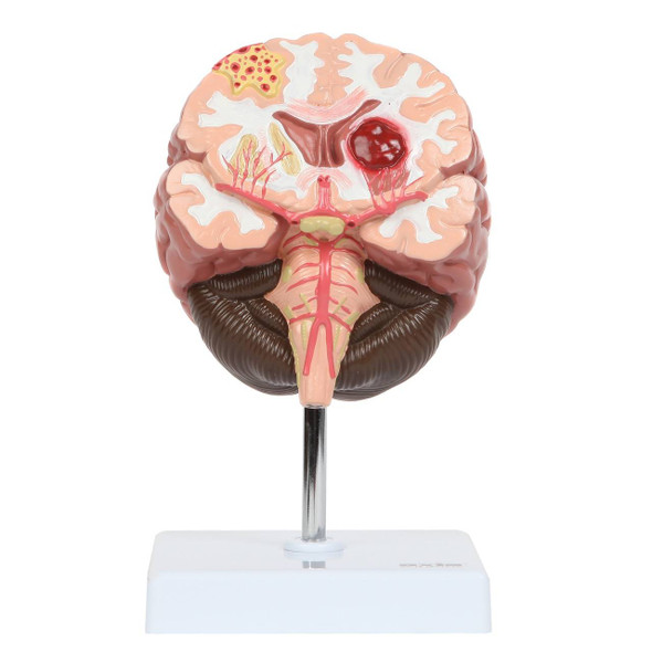  Educational Model,9-Part Human Brain Model Anatomy Life Size Human  Brain Anatomical Model with Display Base Color-Coded Artery Brain Teaching  Brain Anatomy for Study : Industrial & Scientific