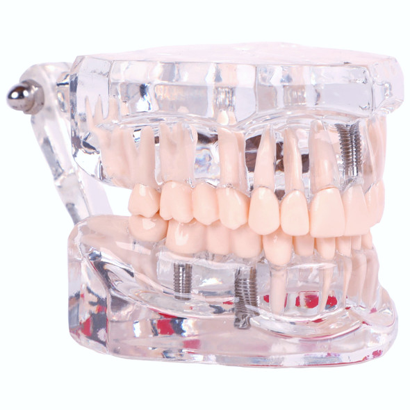 Axis Scientific Transparent Permanent Teeth Anatomy Model 1