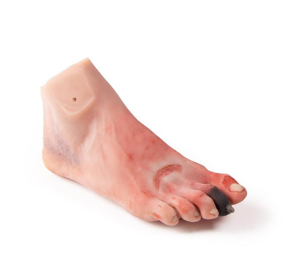 Wound Foot with Diabetic Foot Syndrome, Manikin Version