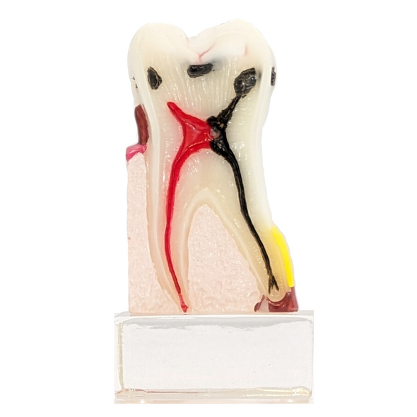 Dental Tooth Teeth Anatomical Anatomy Model Children Dental Model Baby teeth  mold - AliExpress