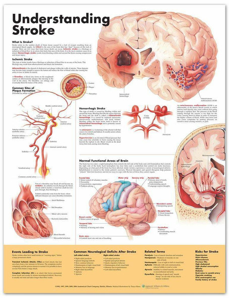 Understanding Breast Cancer Laminated Anatomical Chart - 4th Edition