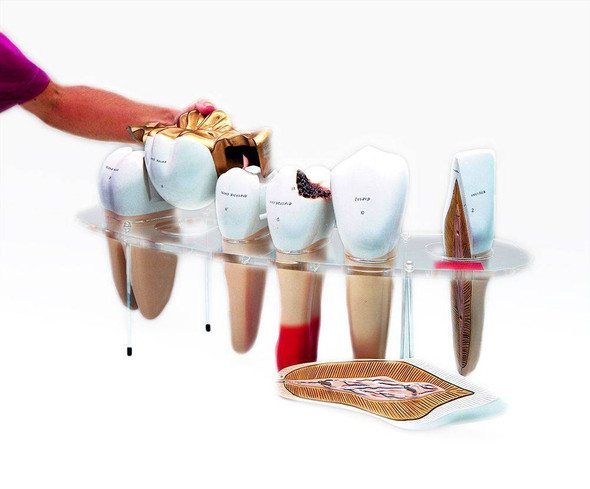 Anatomical Diseased Teeth And Gums Model – Dental Hygiene Medical Tooth Anatomy, MedicalModels Brand