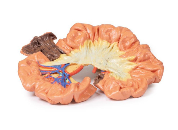 3D printed portion of ileum. full view. Exposed arteries.