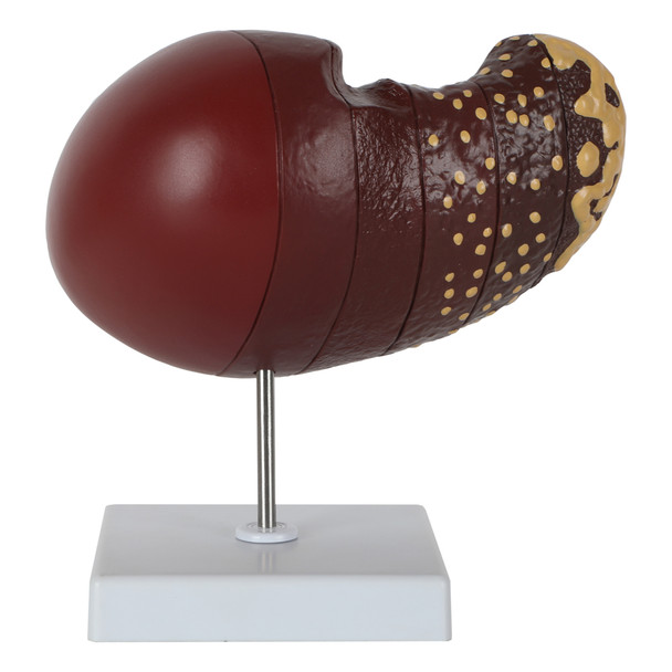 Axis Scientific Life-Size Human Liver with the Progression of Liver Disease