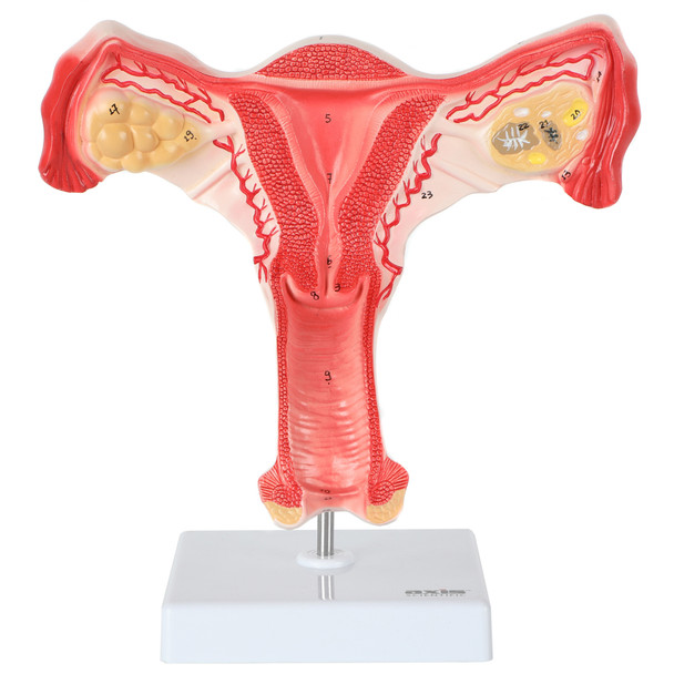 Axis Scientific Female Genital Organs Model - Front View
