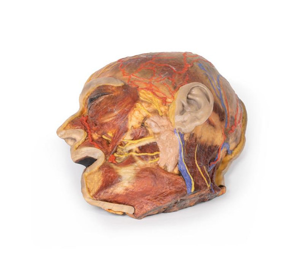 3D Printed Superficial Dissection of Facial Nerves and Parotid Gland
