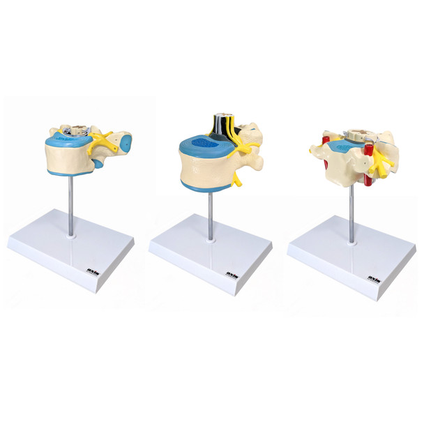 Axis Scientific Enlarged Vertebra with Spinal Cord and Nerves, 3-Piece Anatomy Model Set