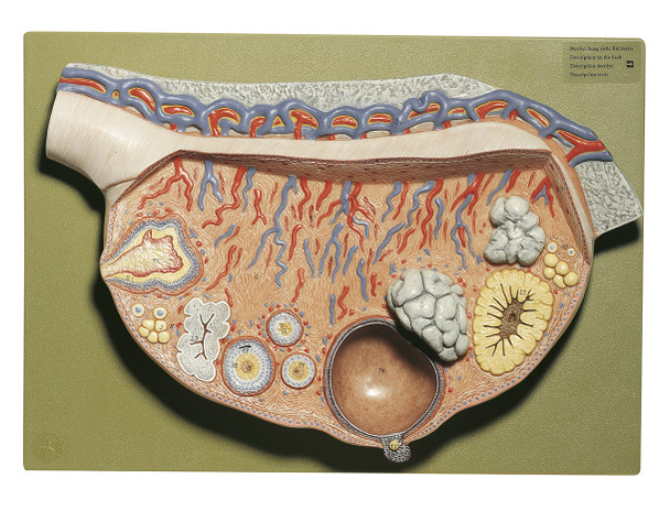 SOMSO Relief Model of the Ovary