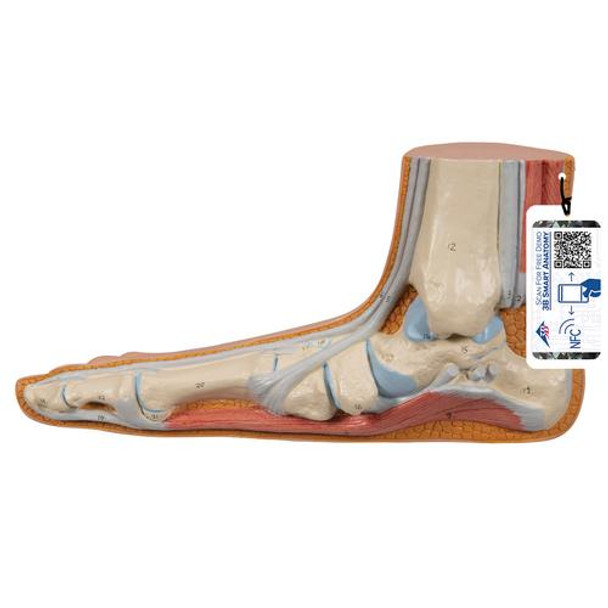 Flat Foot Pes Panus Anatomy Model