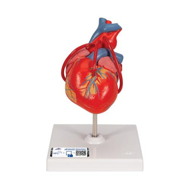 Classic Heart Anatomy Model With Bypass