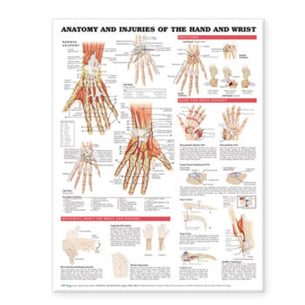 Anatomy and Injuries Of The Hand and Wrist Laminated Anatomical Chart