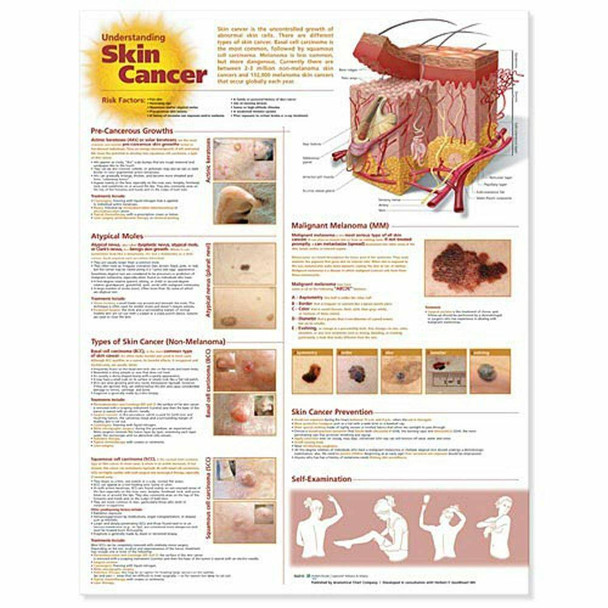 Understanding Skin Cancer Laminated Anatomical Chart - 2nd Edition
