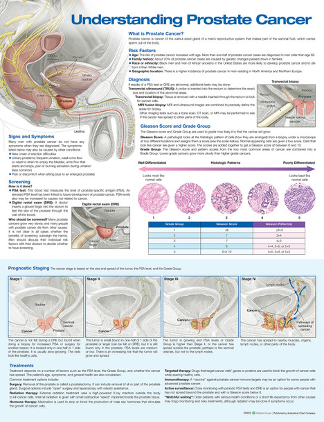 Understanding Prostate Cancer Laminated Chart - 3rd Edition