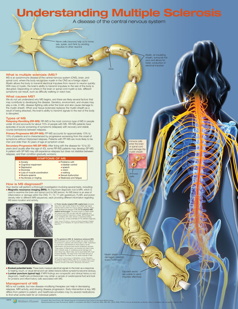 Understanding Multiple Sclerosis Laminated Anatomical Chart - 2nd Edition