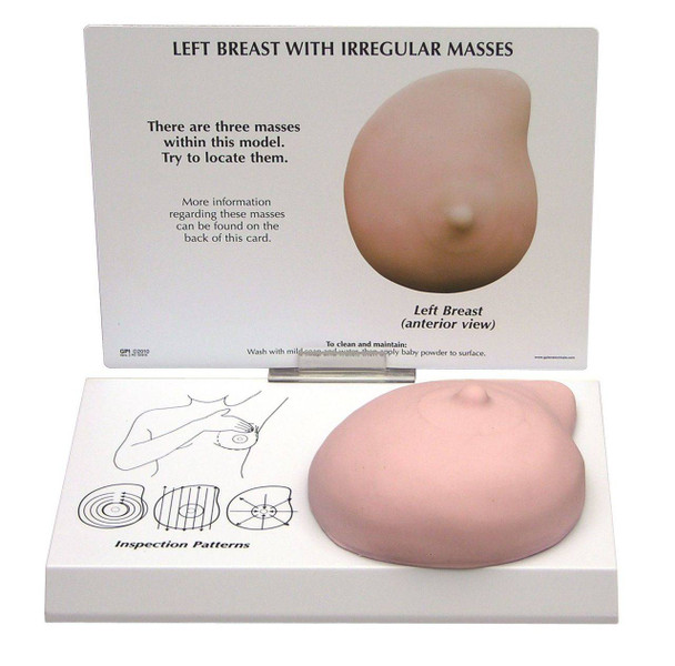 Left Breast Anatomy Model - Soft Tissue With 3 Pathologies