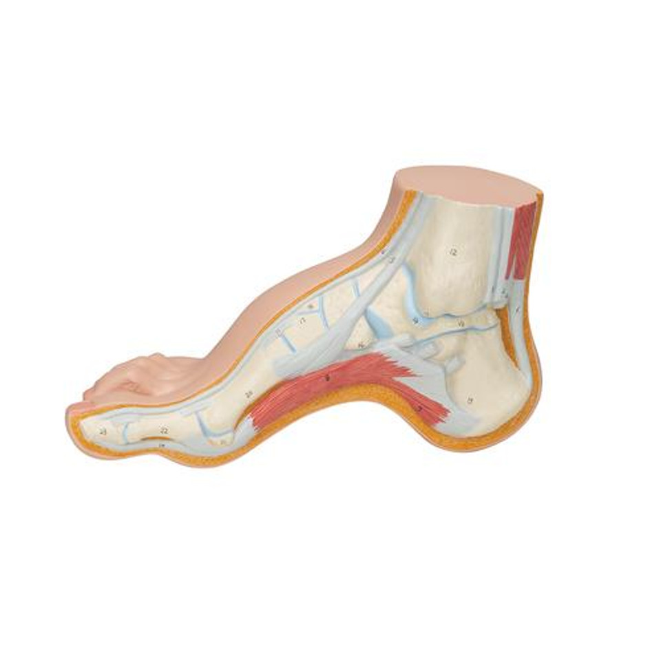Anatomy Model Pes Hollow Foot (Pes