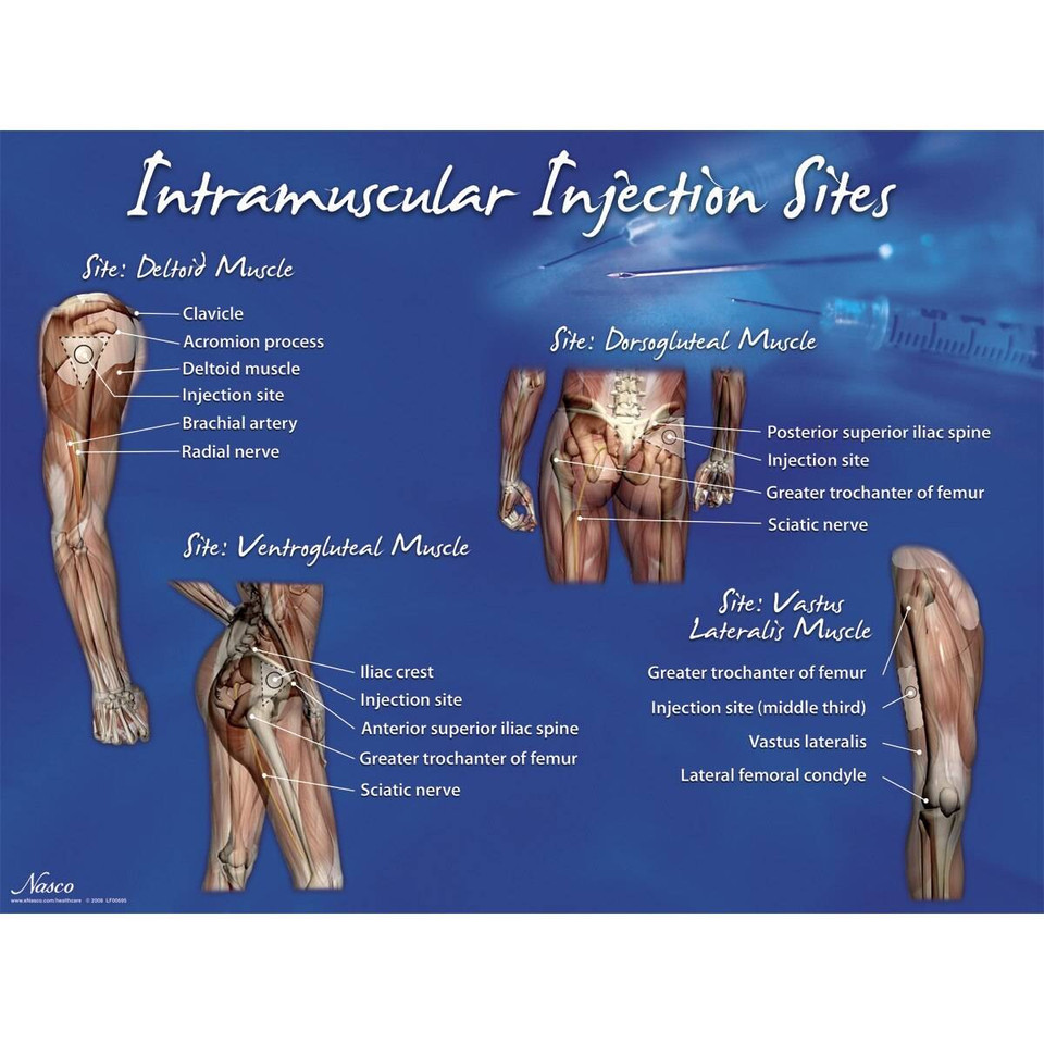 Injectiton Nasco Healthcare Intramuscular Injection Visual Aid Chart | Anatomy ...