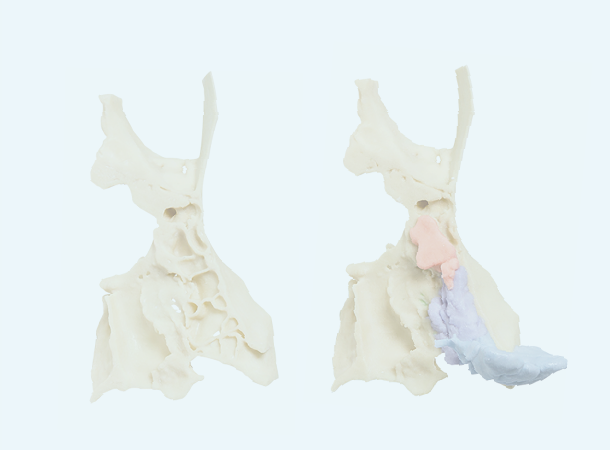 A diagram shows two light beige head and neck bones, with the bone on the right having some additional pink, purple, and light blue pieces attached to it.