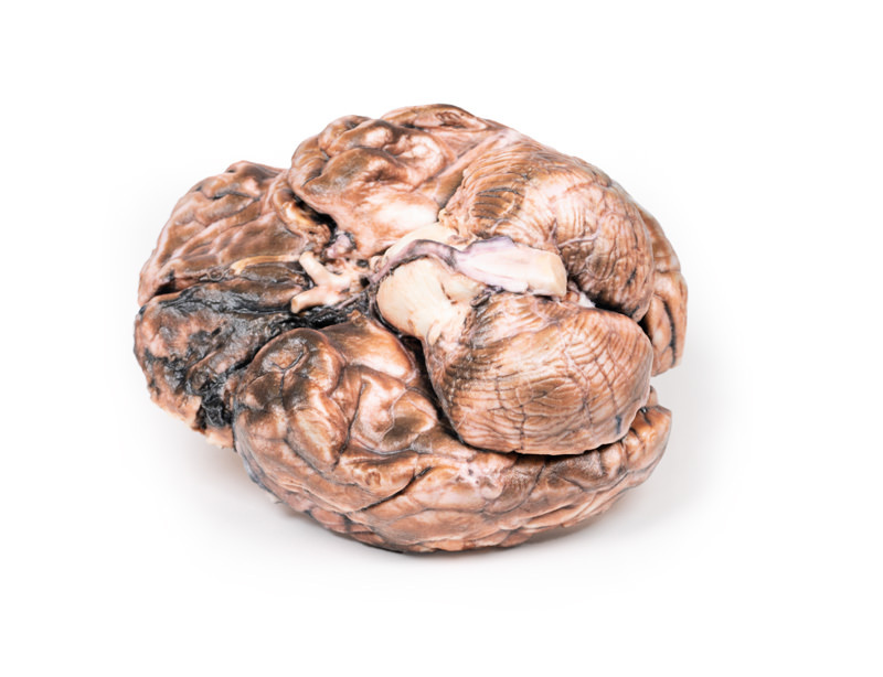 Human Cadaver Pathology Replica Models