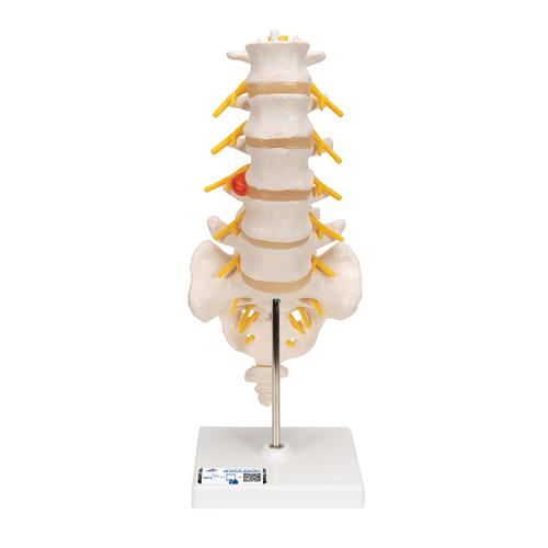 A76-5_01_Human-Lumbar-Spinal-