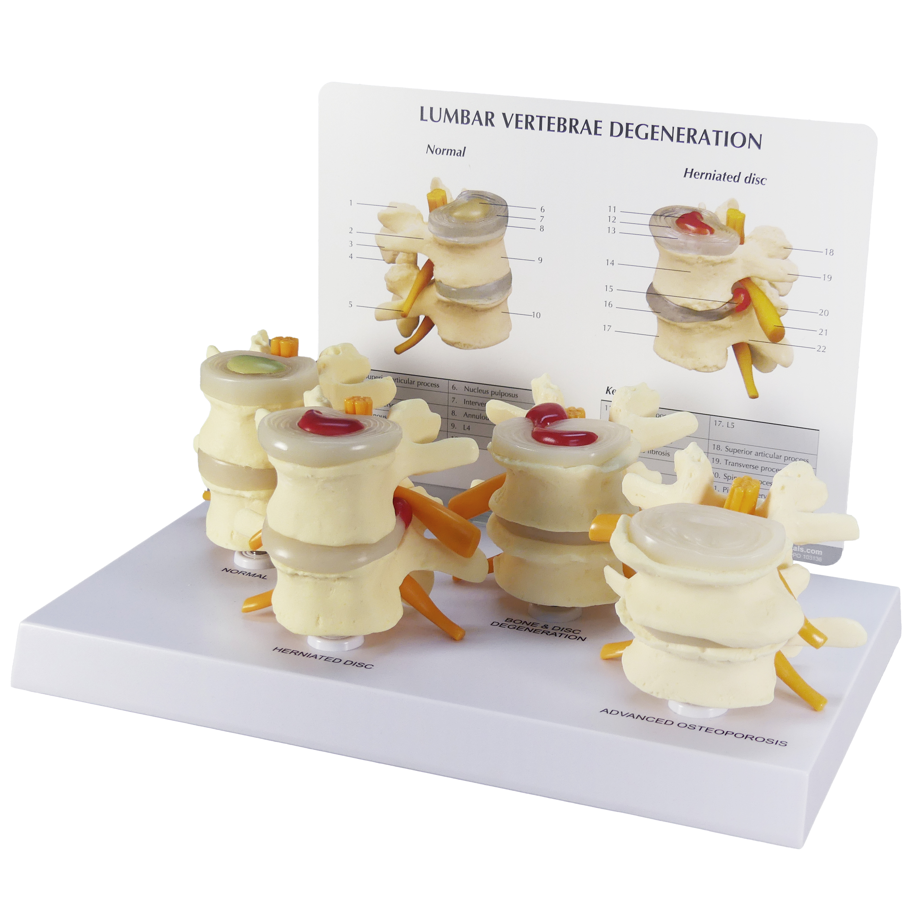 GPI Anatomicals Four Stage Vertebrae Set Anatomy Model | Anatomy