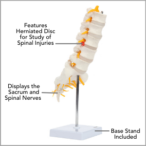 Axis Scientific Lumbar Vertebral Column with Sacrum and Spinal Nerves Anatomy Model Main Features.