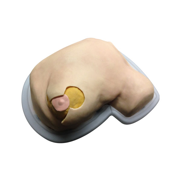 Mastopexy and Breast Revisions Model - Operable Model 