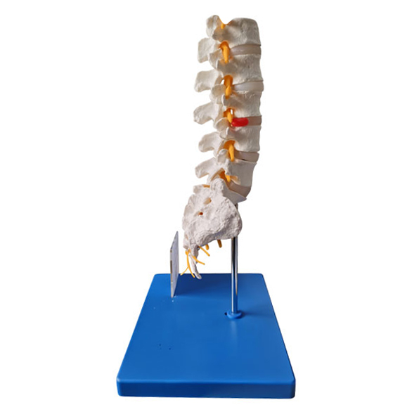 Custom Lumbar Model with Branding and Client Device Demonstration - Side Image